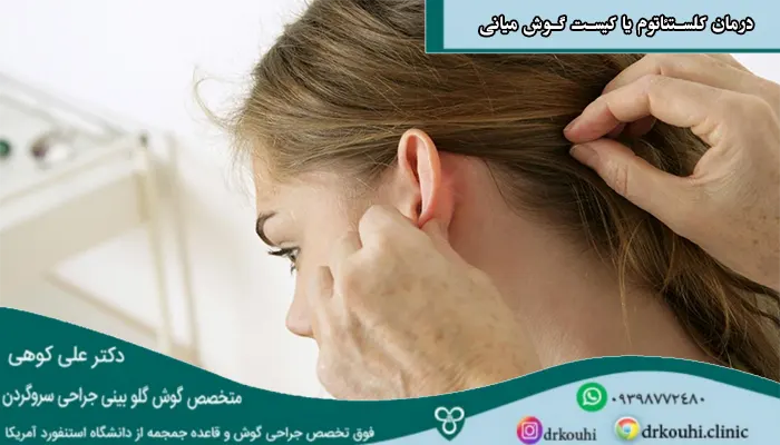 درمان کلستئاتوم یا کیست گوش میانی