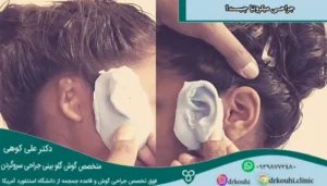 جراحی میکروتیا چیست؟