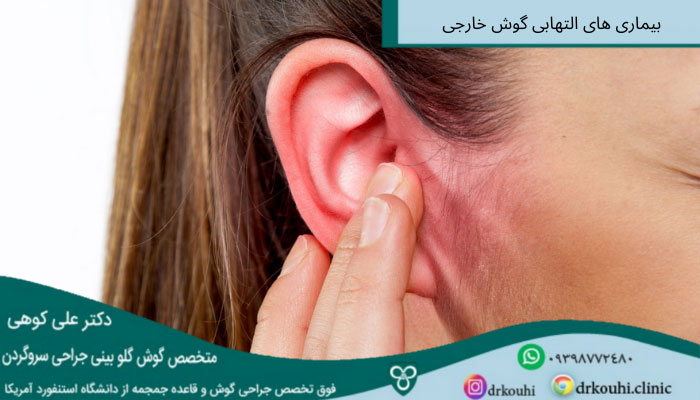 بیماری های گوش خارجی