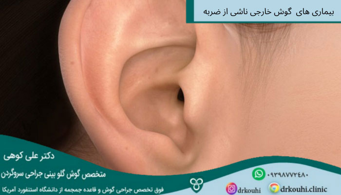 بیماری های گوش خارجی