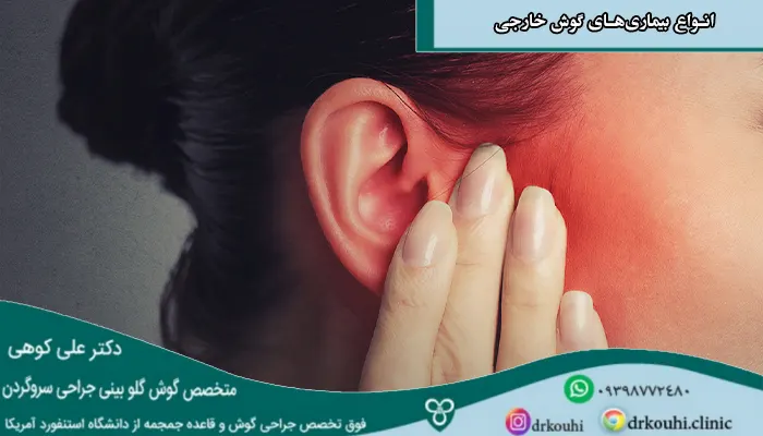 انواع بیماری‌های گوش خارجی