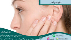 انواع ترشح گوش