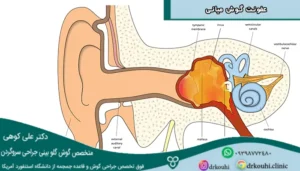 علائم عفونت گوش میانی + پیشگیری و درمان عفونت گوش میانی