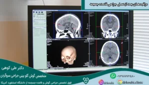 تصویری از بهبود وضعیت مغز بعد از مراقبت‌های عمل جراحی قاعده جمجمه