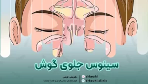 سینوس جلوی گوش