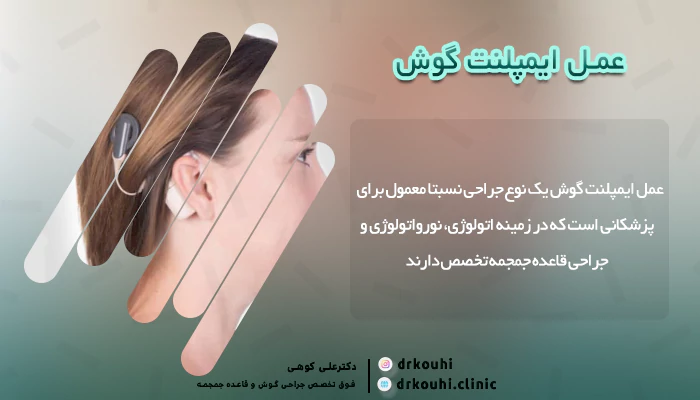 مراحل کاشت ایمپلنت گوش