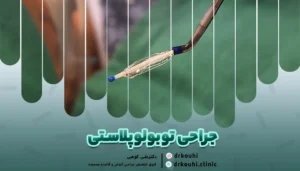 تصویری از جراحی توبولوپلاستی
