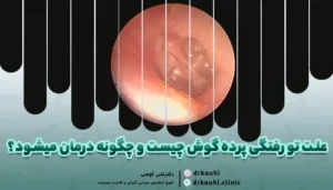 درمان تو رفتگی پرده گوش