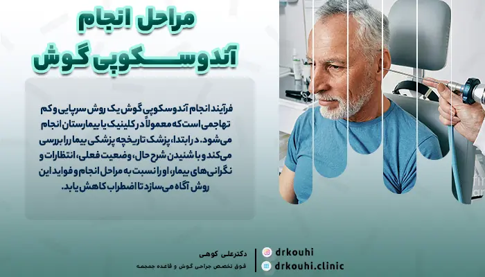مراحل انجام آندوسکوپی گوش