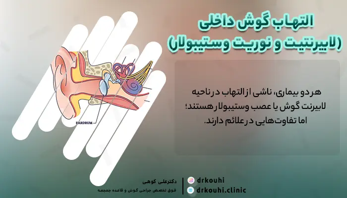 التهاب گوش داخلی و سرگیجه