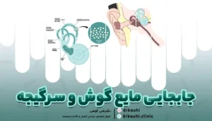 جابجایی مایع گوش و سرگیجه: علل، علائم و راهکارهای درمانی