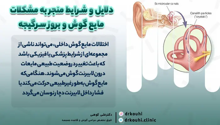 علت اختلال مایع گوش و سرگیجه