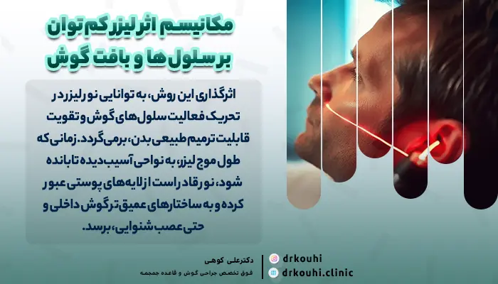 اثر درمان وزوز گوش با لیزر کم توان (LLLT)