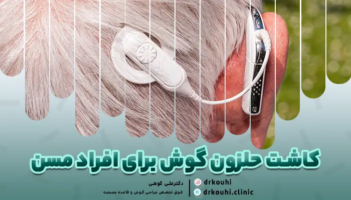 کاشت حلزون گوش برای افراد مسن: مزایا و چالشهای کاشت حلزون گوش برای سالمندان