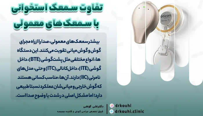 تفاوت سمعک استخوانی با سمعک‌های معمولی