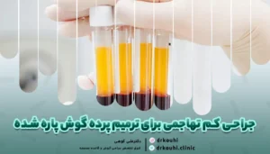 جراحی کم تهاجمی برای ترمیم پرده گوش پاره شده