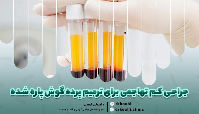 جراحی کم تهاجمی برای ترمیم پرده گوش پاره شده