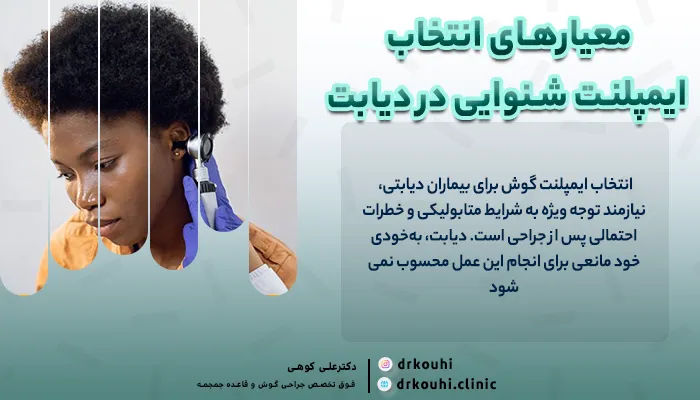 معیارهای انتخاب ایمپلنت شنوایی در دیابت | کاشت ایمپلنت شنوایی در بیماران دیابتی