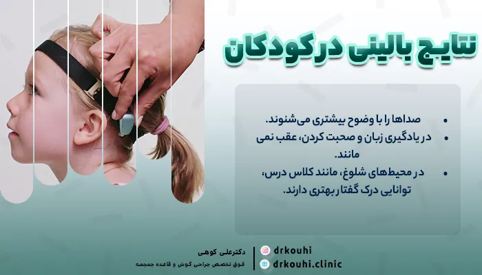 نتایج بالینی کاشت حلزونی استخوانی در کودکان با مشکلات شنوایی
