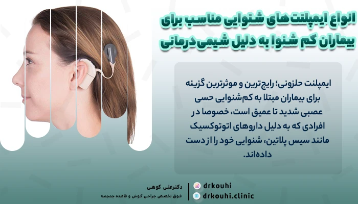 انواع ایمپلنت‌های شنوایی مناسب برای کم شنوایی بعد از شیمی درمانی
