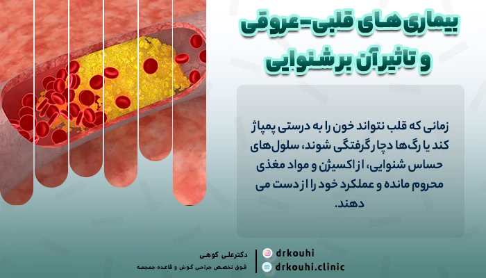 بیماری‌های قلبی-عروقی و تاثیر آن بر شنوایی