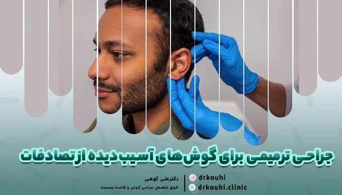 جراحی ترمیمی برای گوش‌های آسیب‌دیده از تصادفات