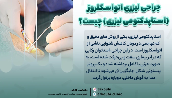 عمل استاپدکتومی لیزری | جراحی درمان بیماری اتواسکلروز گوش