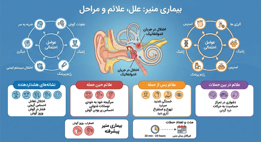 تفاوت میگرن وستیبولار (تعادلی) و بیماری منیر + علائم مشترک