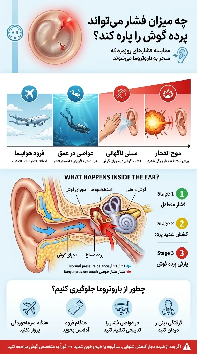 اینفوگرافیک چه میزان فشار میتواند پرده گوش را پاره بکند؟